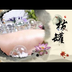 Acupunctuur Yi Xiao Tang image 4