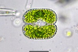 Nieuwe algensoort ontdekt in natuurgebied het Zwanenwater