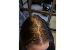 HAAR.INK in Schagen trekt vrouwen uit heel Nederland met unieke aanpak micro haarpigmentatie