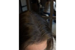 HAAR.INK in Schagen trekt vrouwen uit heel Nederland met unieke aanpak micro haarpigmentatie